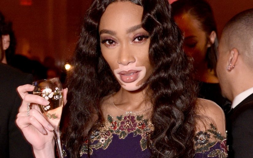 NEW YORK, NEW YORK - FEBRUARY 06: Winnie Harlow attends the amfAR Gala New York 2019 at Cipriani Wall Street on February 06, 2019 in New York City. (Photo by Bryan Bedder/Getty Images for Perrier-Jouët and Absolut Elyx)